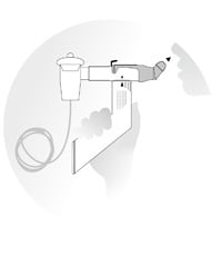 Cegla Cegla RC-Cornet PLUS Neus set